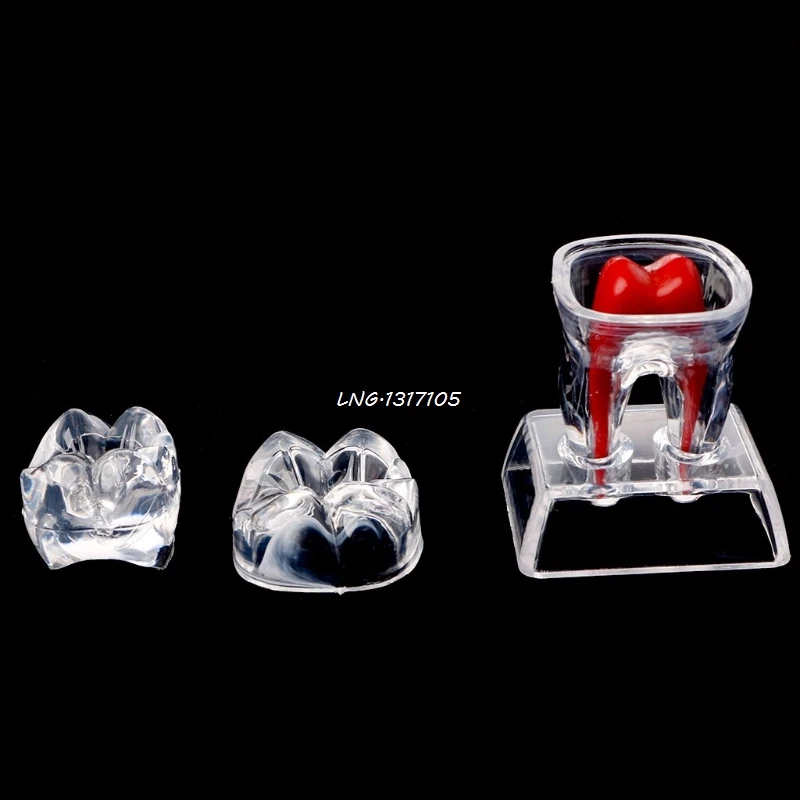 Стоматологическая база жесткий пластик Зуб Молярная Модель Отделяемая подходит для улыбки LNB