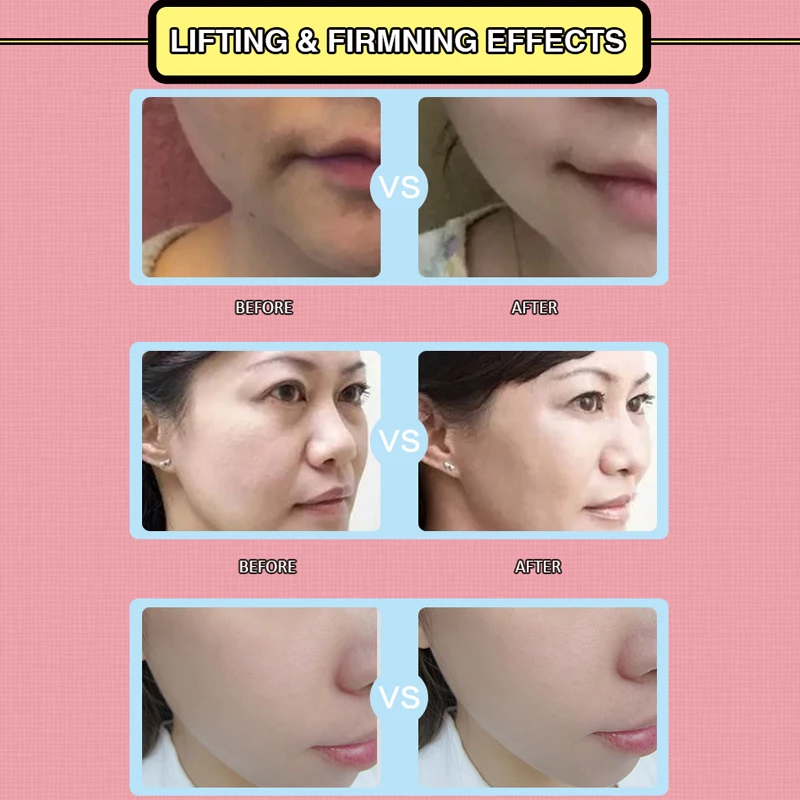maschera viso wikipedia maschera viso wikipedia