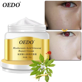 

1PC Hyaluronic Acid Ginseng acne cream Anti-acne print Face cream remover acne treatment Facial Eliminates Oil control Skin care