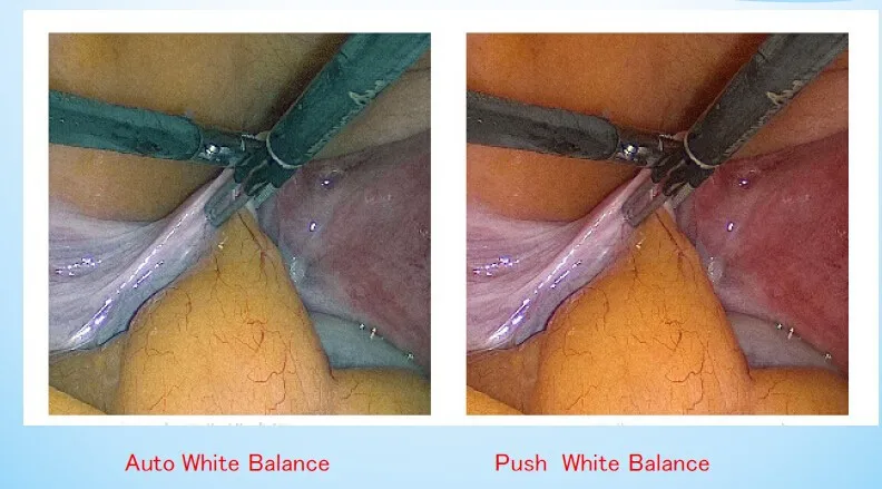 endoscopy camera7