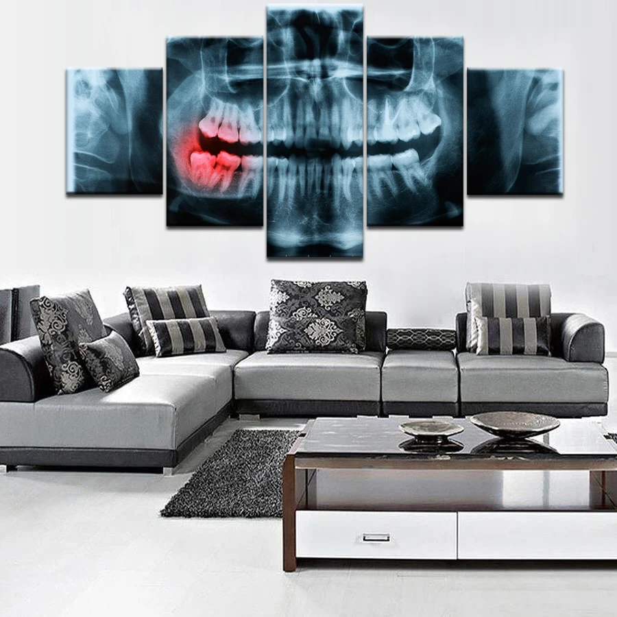 5 шт. холст x-ray болезненные зубы стоматологический доктор картина холст Картина декор комнаты печать плакат стены Искусство WD-3040