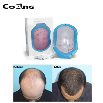 

COZING Laser Therapy Hair Growth Helmet Device Laser Treatment Anti Hair Loss Promote Hair Regrowth Laser Cap Massage Equipment