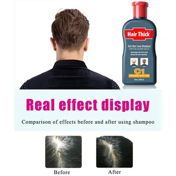 

100ml Natural Anti-Hair Loss Shampoos Oil Control Anti Dandruff Itch Hair Care Hair Thicken Treatment Shampoos