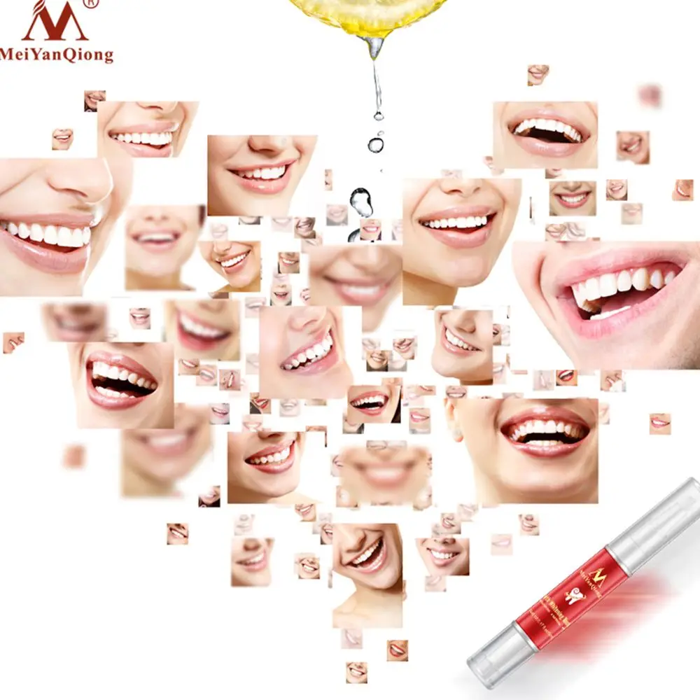 MN3_2C