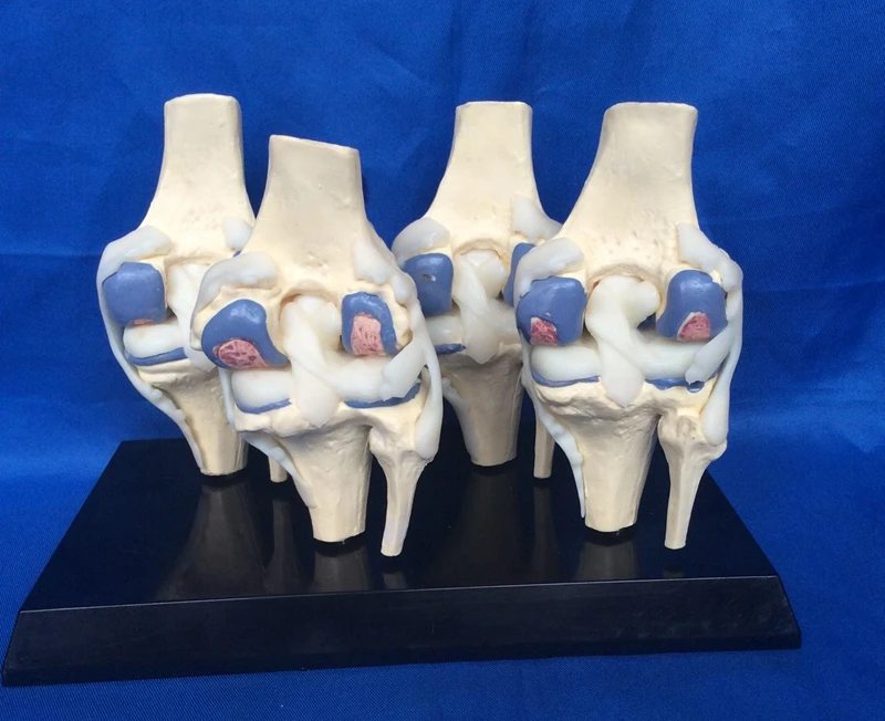 1:1 ЖИЗНЬ Размеры человека модель коленного сустава 4 этап коленного сустава болезни модель скелета череп для изучения анатомии медицинское