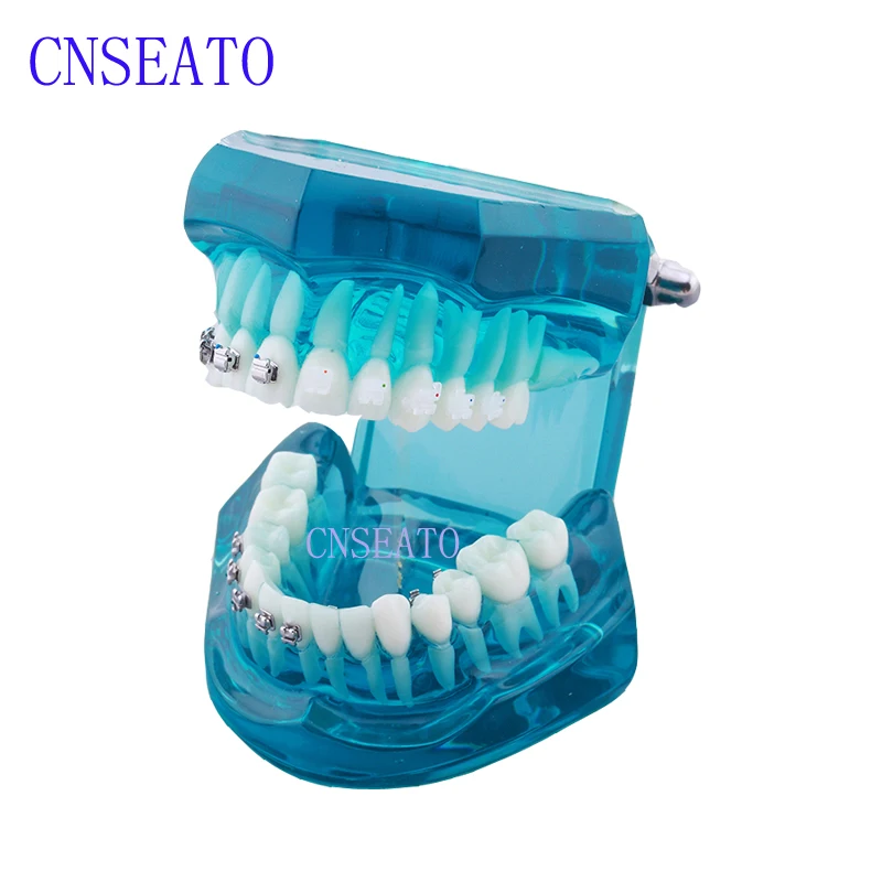 

1 Pc Dental Model Orthodontic 4-type Brackets Contrast Metal Ceramic Lingual Invisalign Braces