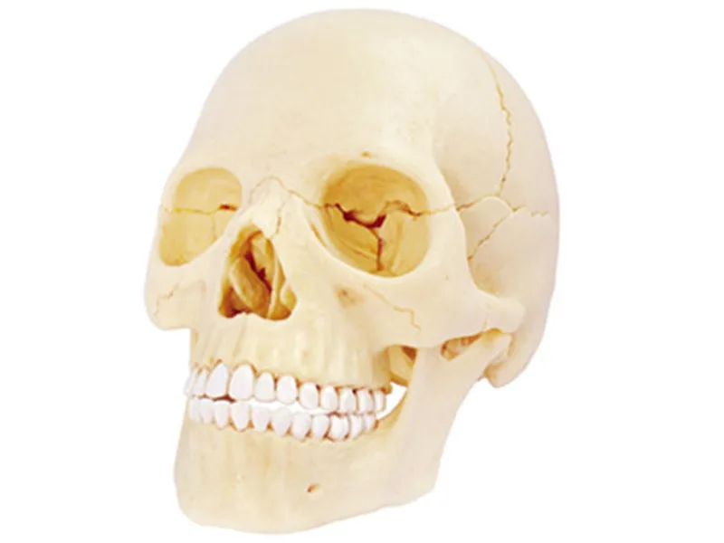 A1