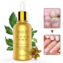 High Quality 30ml Nail Fungal Treatment Liquid for Toenail Fingernail Anti Fungus Infection Nail Care