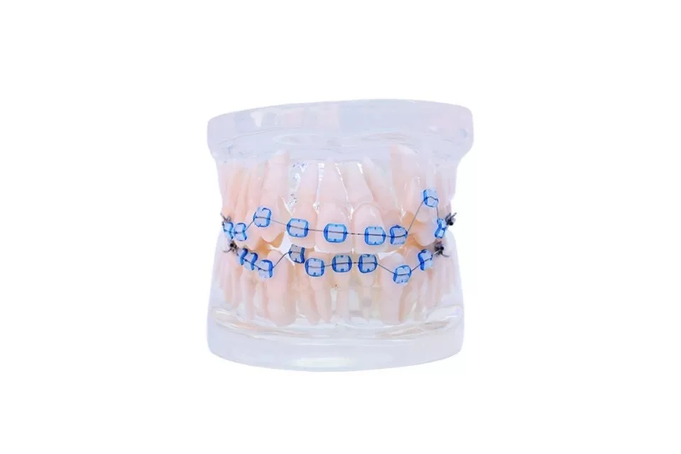 B5-03 Ortho Ceramic Bracket