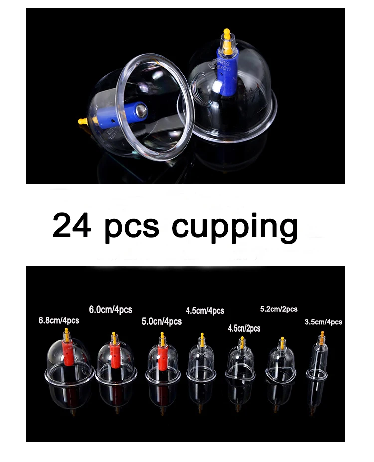 vacuum cupping (1)