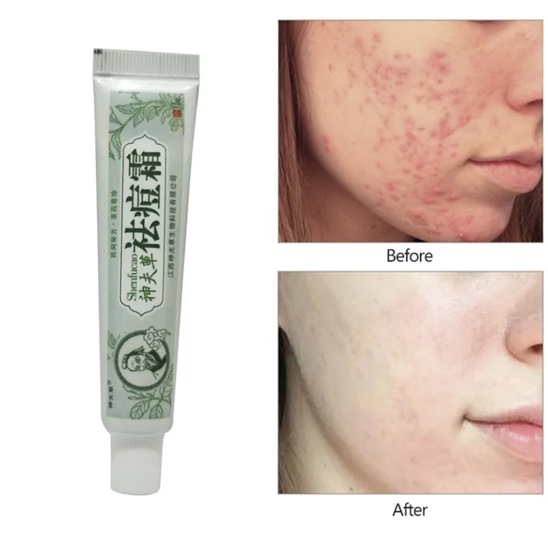 против шрамов на лице