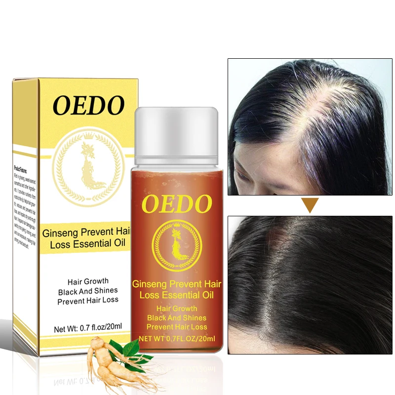20ml Fast Powerful Hair Growth Essence Hair Loss Products
