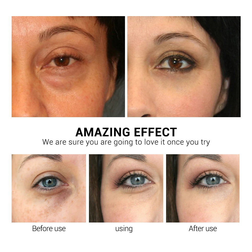  LANBENA Retinol Eye Mask Hyaluronic Acid Eye Patches Serum Reduces Dark Circles Bags Eye Lines Repa - 32952372611