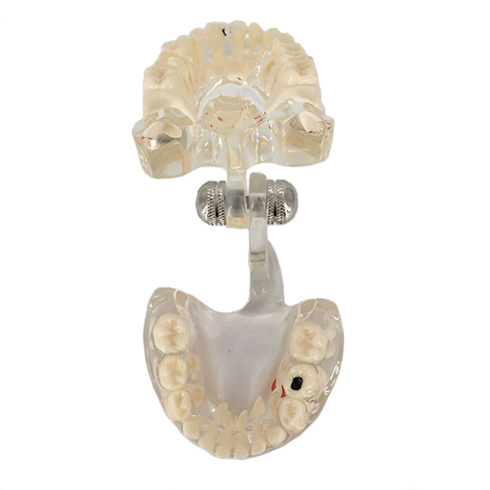 Распавшие зубы модель для детей стандартная прозрачная демонстрационная Стоматологическая модель зубов Модель зубного протеза модель зуба для студентов