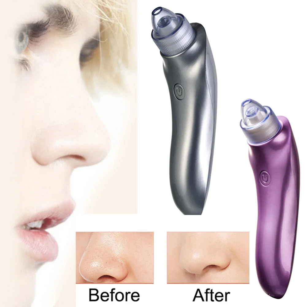 

Vacuum Blackhead Remover Facial Pore Cleaner Comedo Blackhead Cleaning Tool Removedor de espinillas por renare