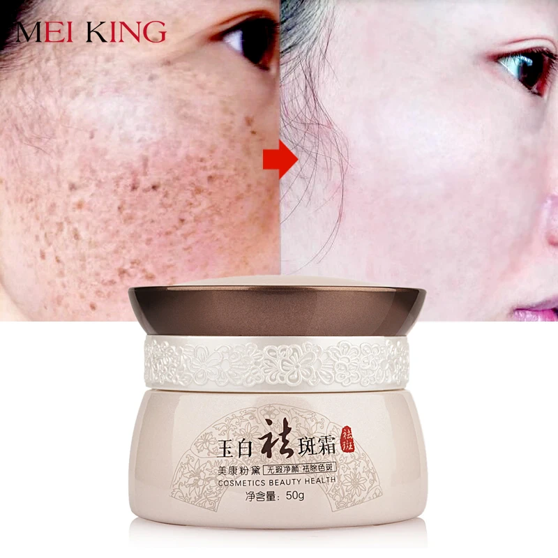 MEIKING Крем для лица по уходу за кожей Brighten Отбеливание Anti-Aging дневной крем Уход за кожей Удалить Загар Пигментация Хлоазма крем 50 гр