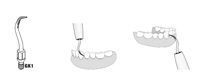 3 шт. GK1 Многофункциональный скалер наконечник совместим с Sirona siroair
