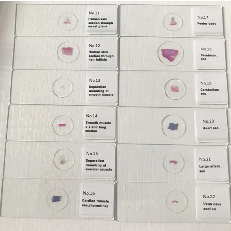 histology slides image pro plus yellow histology slides image pro plus yellow