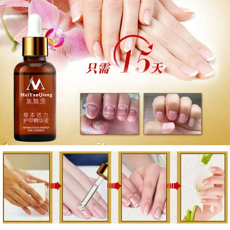 30ML Fungal Treatment Essence Foot Whitening Toe Removal Nail Feet Care Serum