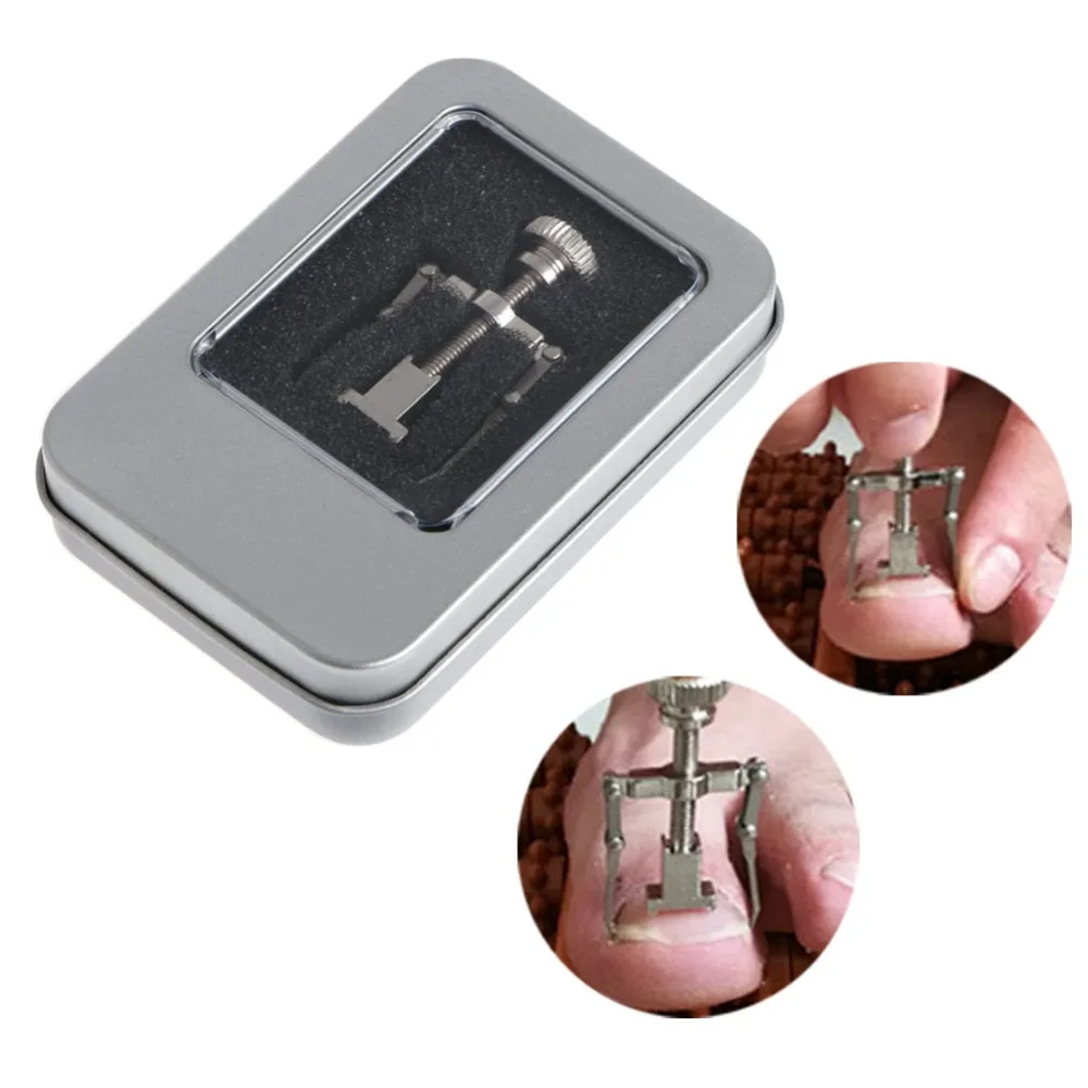 

Ingrown Toe Nail Correction Tool Nail Care Fixer Pedicure Foot Toenail Recover