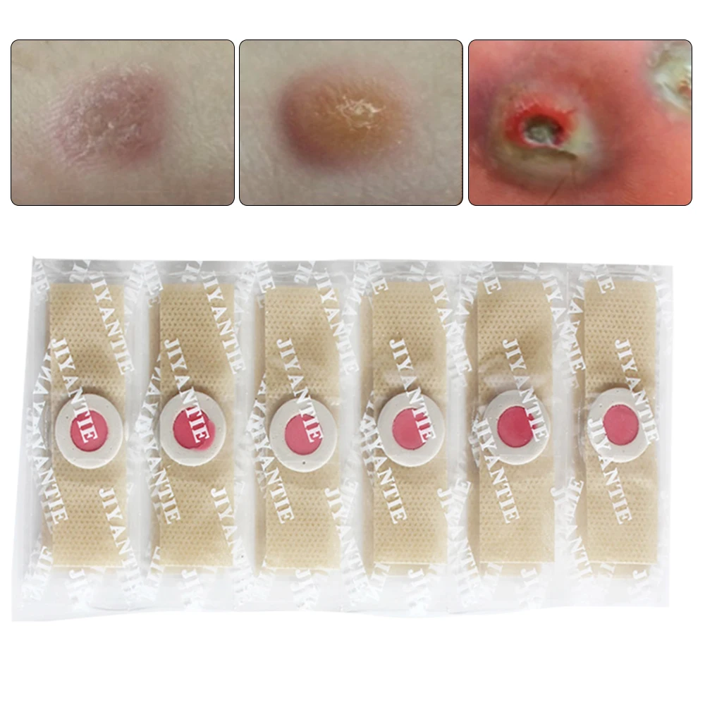 

6/12pcs Foot Care Medical Plaster Foot Corn Remover Relieving Pain Patch Blisters Corn Friction Detox Foot Pad Patches
