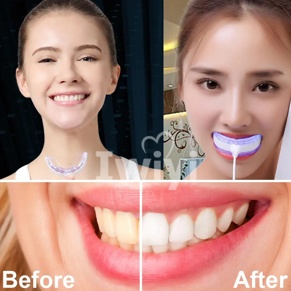 Набор для отбеливания зубов с 3 интерфейсами 16 светодиодов|dental care|strip toothteeth whitening