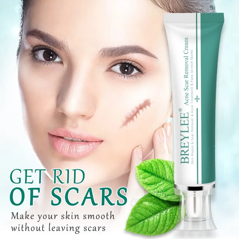 

Face Acne Scar Removal Cream Repair Skin Care Scar Treatment Remove Stretch Marks Beauty Whitening Cream Dropshipping