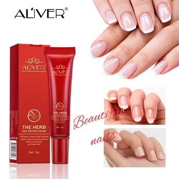 

Good Result Toe Nail Fungus Treatment Cream Onychomycosis Paronychia Anti Fungal Nail Infection Chinese Herbal Material Ointment