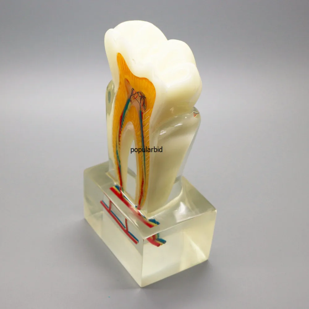 Ортодонтическая модель 6:1 зубы нерв анатомическая разборка демонстрация стоматолога эндодонтика обучение с ясным основанием