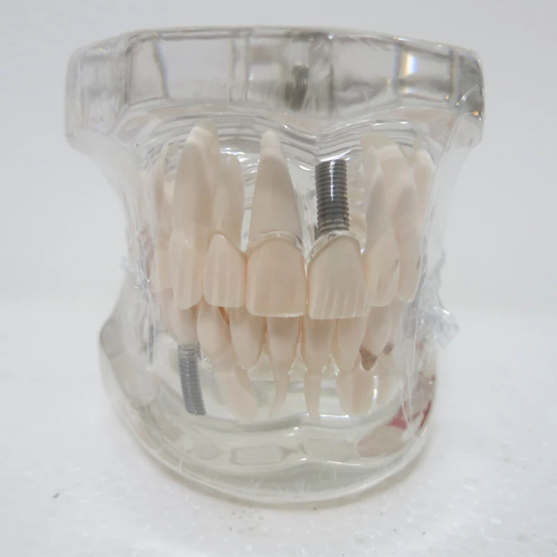 Стоматологические материалы съемные стоматологические патологические модели специальные украшения клиника украшения на заказ фигурки