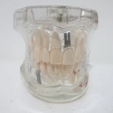 Materiali dentali Orali rimovibile patologico modello dentale decorazione Speciale Clinica personalizzati decorativi Figurine