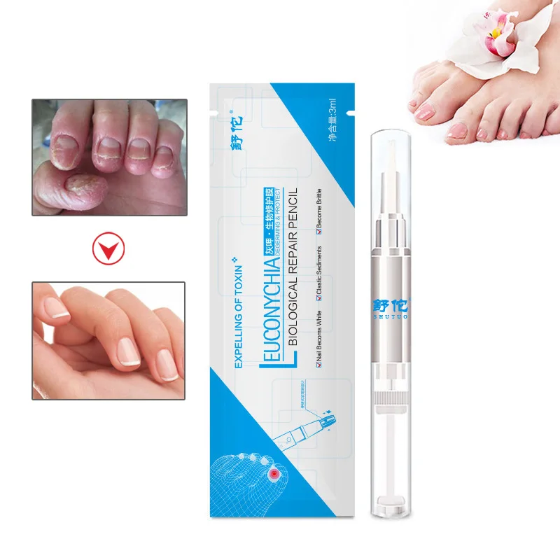 

3ML Anti Fungal Treatment Nail Pen Onychomycosis Paronychia Infection Herbal Toe Finger Nails Health Beauty Accessories