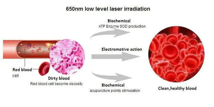 

Portable tympanitis Soft Laser Treatment easy to operate.Pain relief device.