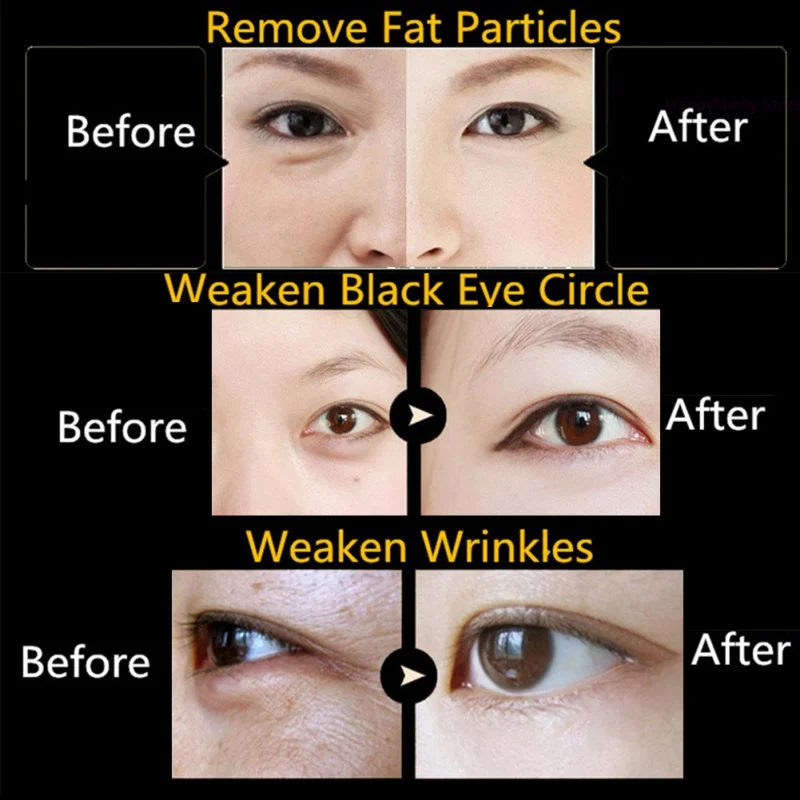 1 шт. золото кристалл коллагеновая маска для глаз Eye Нашивки для глаз Anti-wrinkle Eye Уход за лицом Новый