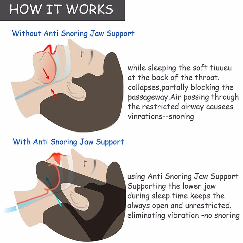 71w8YmDpKLL._SL1500_