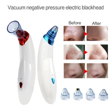 5 в 1 Угри Акне Электрический вакуумный удалитель всасывания машина для удаления клубники нос Очищающий Инструмент для лица массаж Красота