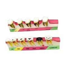 Oral Material Model for Explaining Teaching Dental Clinic Model Jewelry Decorative Ornaments Gift