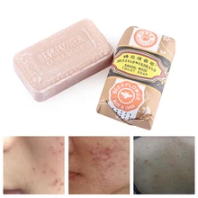 Сандаловое дерево, Отбеливающее мыло бар угри, прыщи, для лица, носа, Чистка Пор инструмент для удаления черных точек антибактериальными свойствами для ванны и душа для тела по уходу