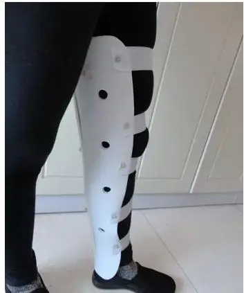 

Adjustable Polymer PVC Knee Joints Fractures fixation Pain Appliances Orthopedic Limbs Stent fixed Knee Plastic brace left right