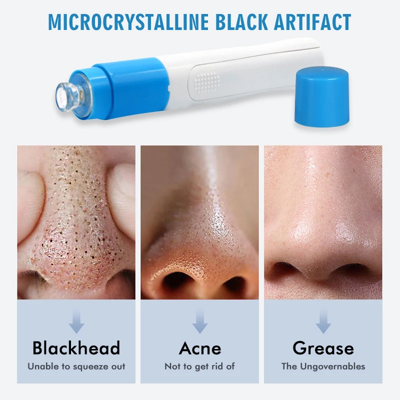 

Electric Suction Blackhead Remover Vacuum Facial Pore Cleaner Acne Treatment Facial Tools Machine maquillage Beauty Instrument