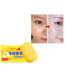 85 г сульфатное мыло Шанхай кожа от акне, псориаза клевета антибактериальное противовоспалительное Парфюмерное масло пузырьковая Ванна здоровые мыла