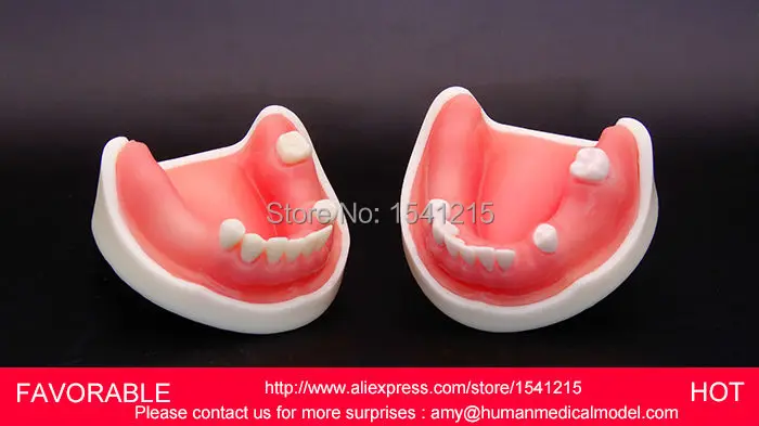 

ADULT DENTAL TEETH NATOMIACL TOOTH, MEDICAL ANATOMICAL MODEL TOOTH MODELS MOUTH ORAL MODEL-GASEN-DEN016