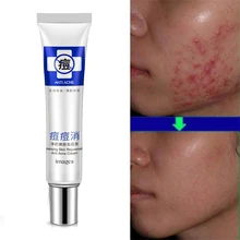 Тонизирующий Успокаивающий Крем для удаления акне питает, удаляет акне, крем для ухода за лицом