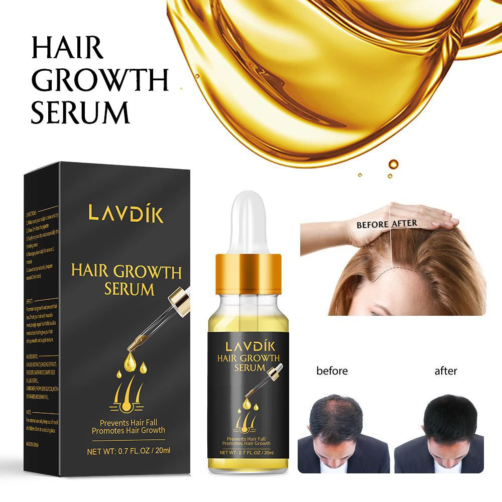 Сыворотка для быстрого роста волос LAVDIK имбирь эфирное масло против потери волос жидкость для восстановления поврежденных волос растущие женские и мужские TSLM1