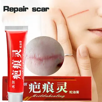 

Herbal Chinese Medicine Remove Scar Cream Scar Gel Acne Scar Removal Cream 60g Skin Repair Treatment for Face & The Whole Body