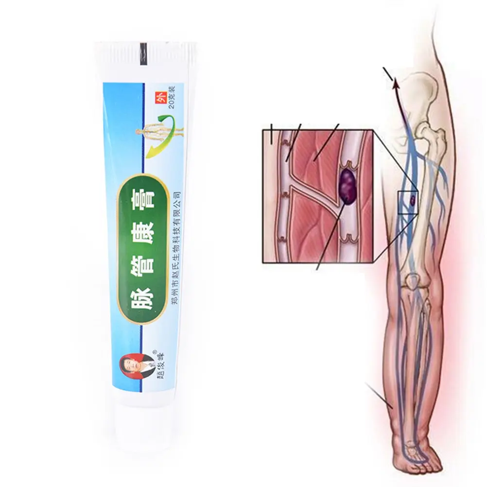 

Health Care Varicose Veins Massage Relaxation Earthworm LegTreatment Leg Acid Bilges Itching Vasculitis Medical Plaster