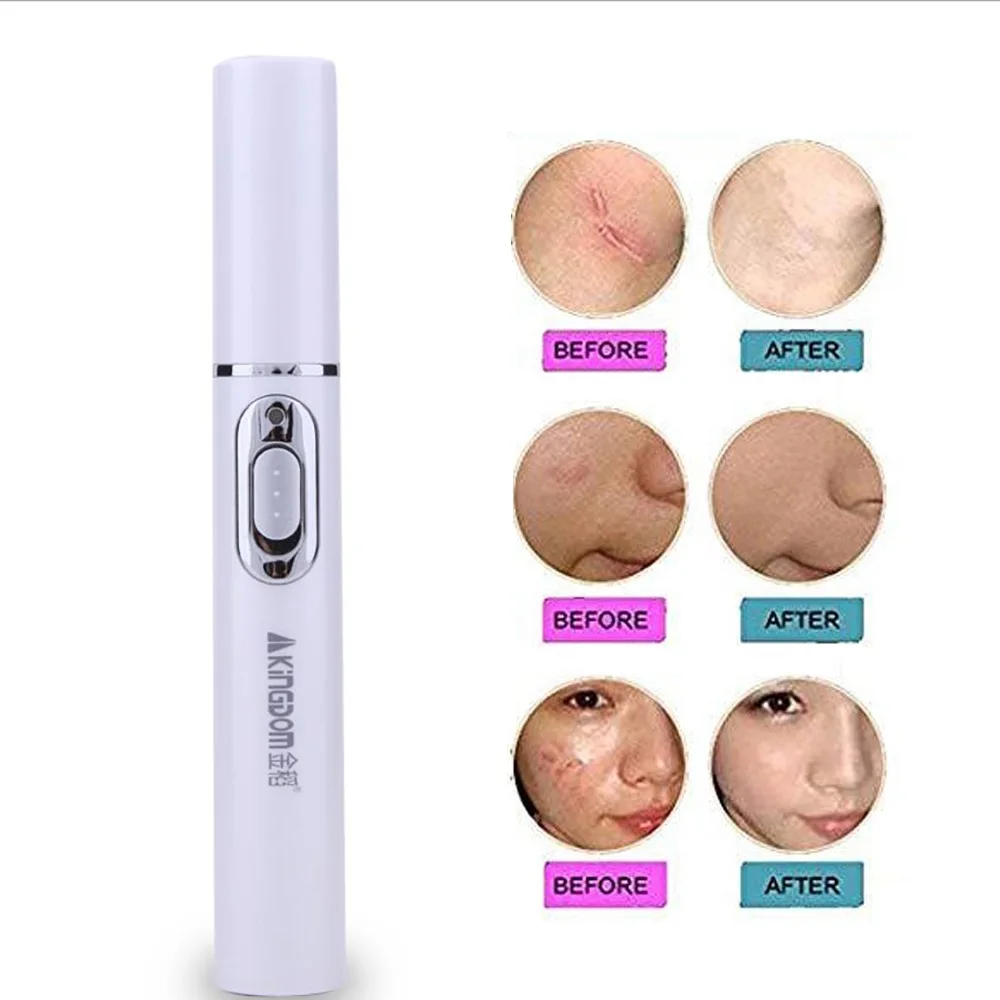 Acne Laser Pen Portable Wrinkle Removal Scar Remover Device Blue Light