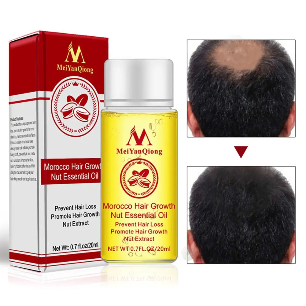 XY Fancy быстрое мощное средство для роста волос выпадение волос Эфирное Масло жидкое лечение предупреждающий потерю волос продукты по уходу