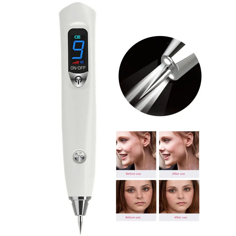 

NEW 9 Level Plasma Freckle Removal Pen Laser Tattoo Facial Tag Wart Removal Beauty Mole Freckle Removal Machine Sweep Spot Pen