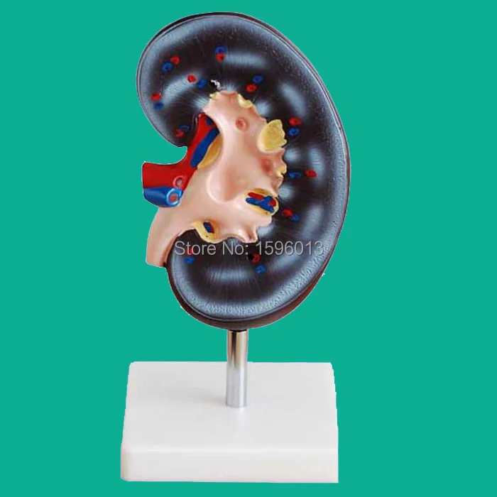 Kidney Model, Anatomical Model of Kidneyin Medical Science from Office